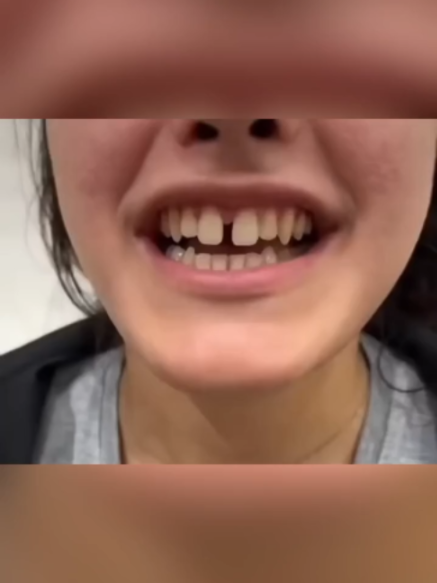 @Tech Dental
