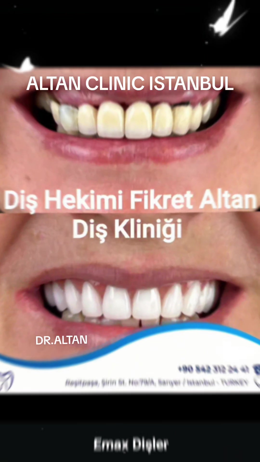 @DişHekimi Fikret Altan Dentist