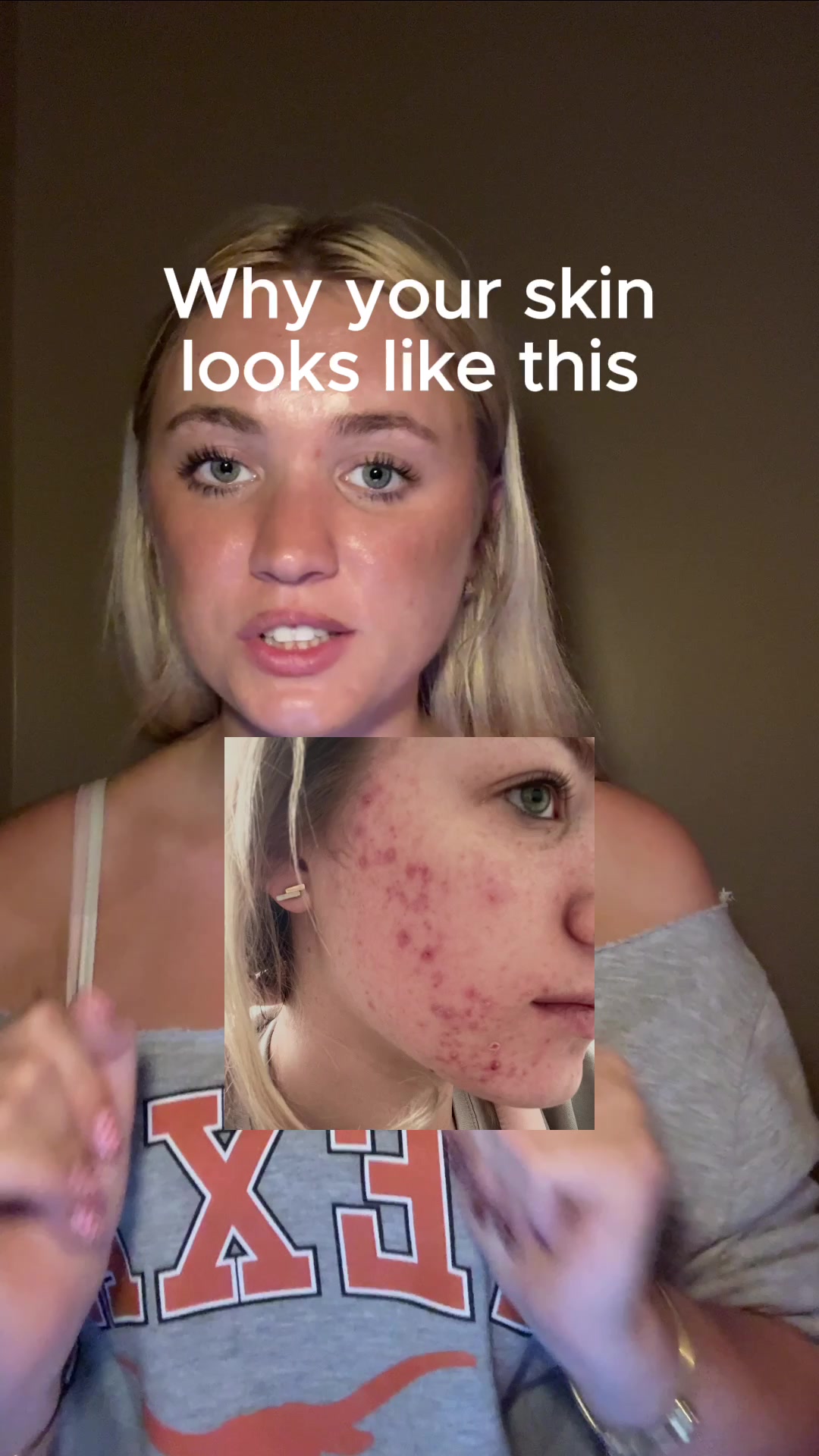 @bellytts