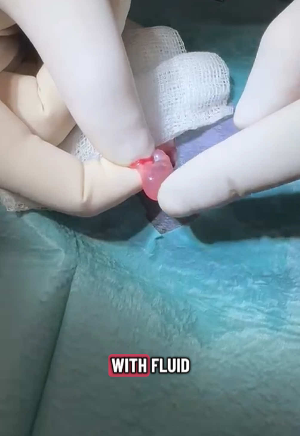 @Tomasthevet