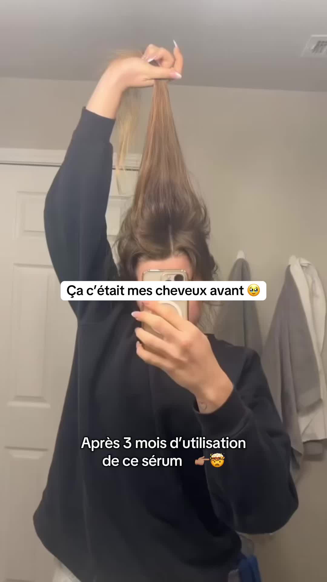 @Lux’Hair Growth FR