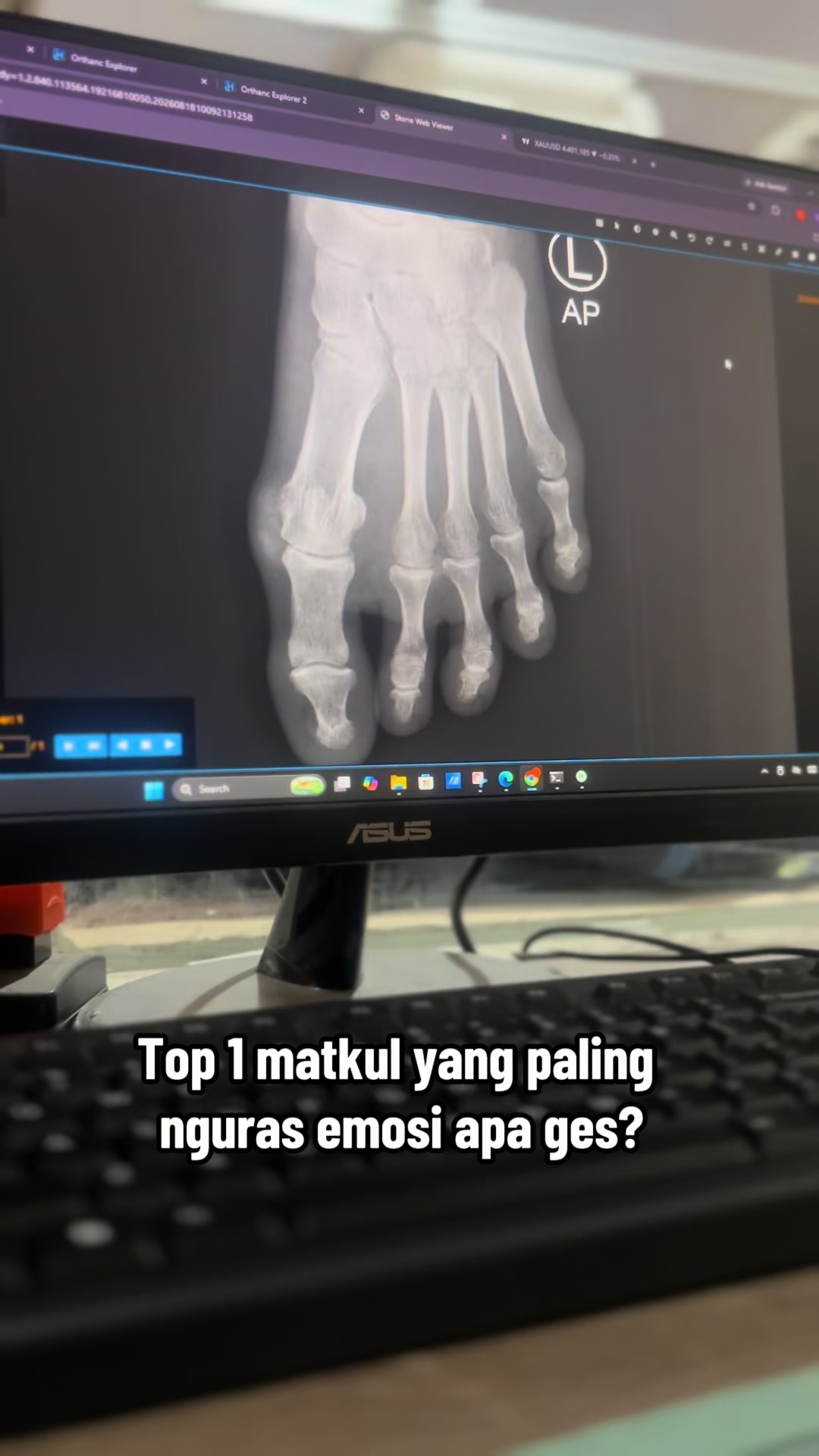 @Sobat Radiology