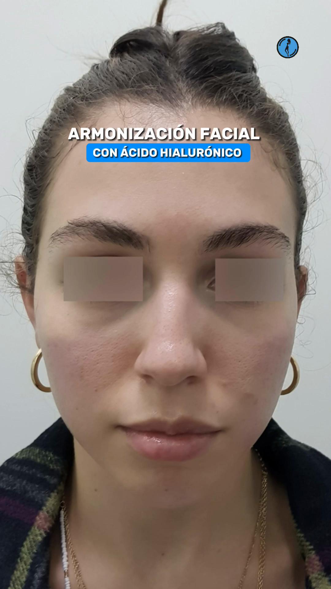 @Belanovacirugiaplastica