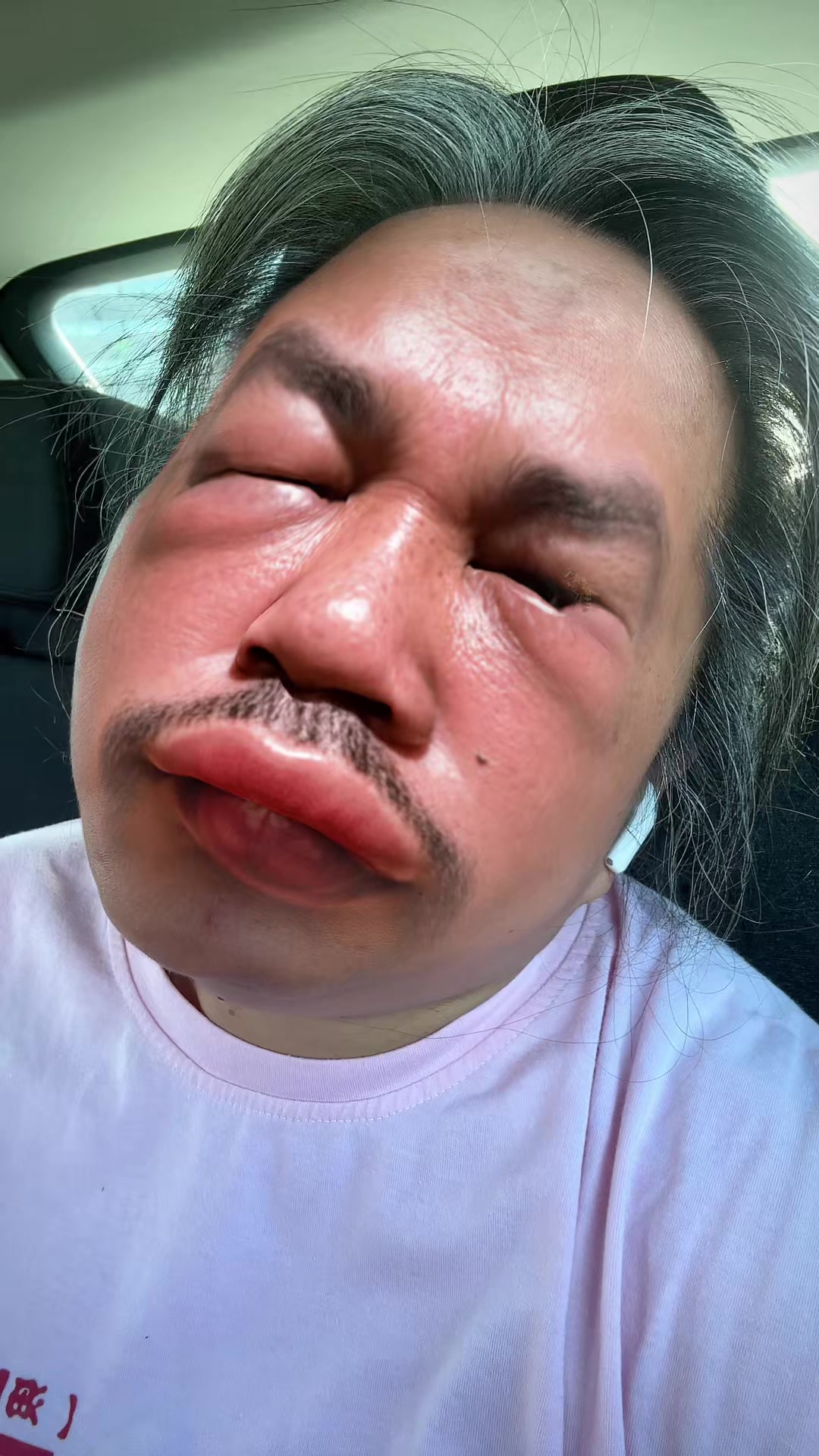 @🧒🏻Chubbyness 🇵🇭🇫🇮