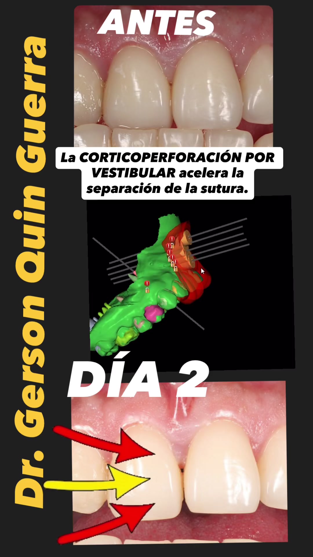 @Dr. Gerson Quin Guerra, PhD