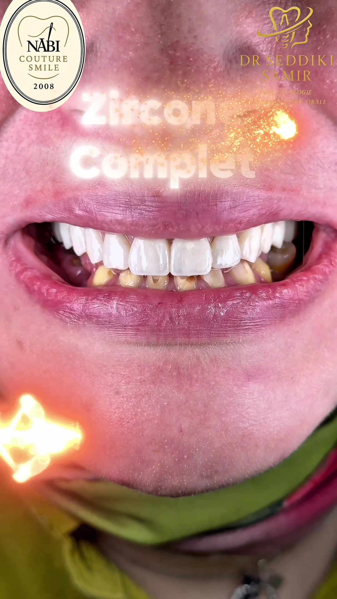 @Dr Nabi-Couture Smile