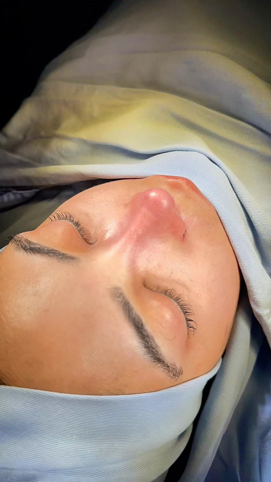 @Eliana Garcés Plastic Surgery