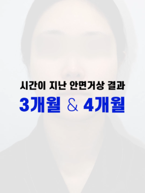 @다시피움성형외과 DASIPIUM タシピウム