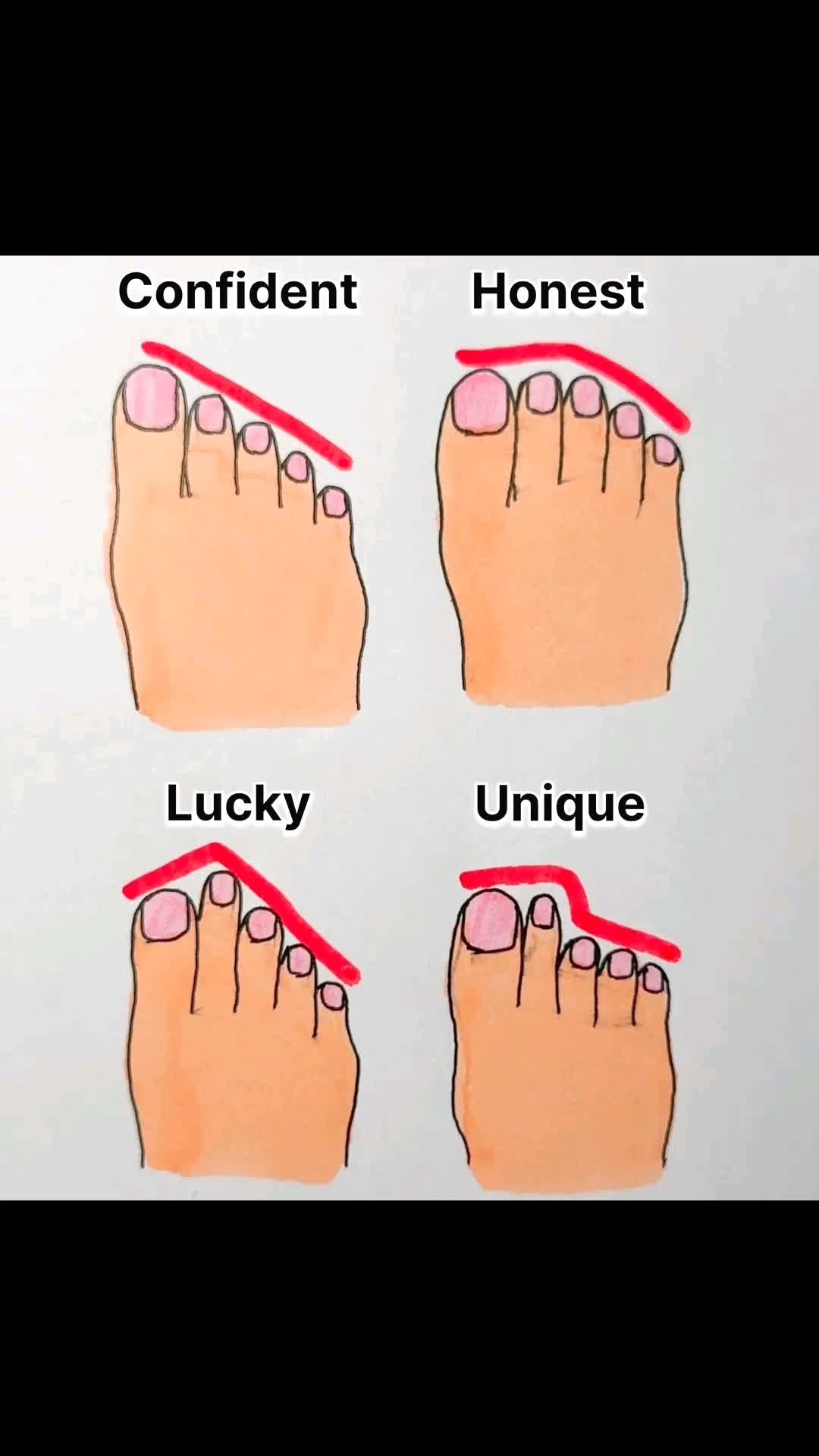 @Anoj94