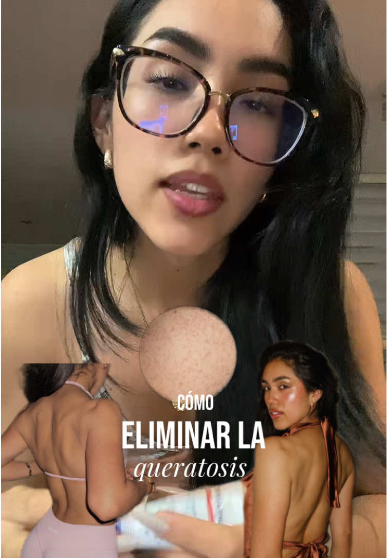 @Dhamara Alcantara