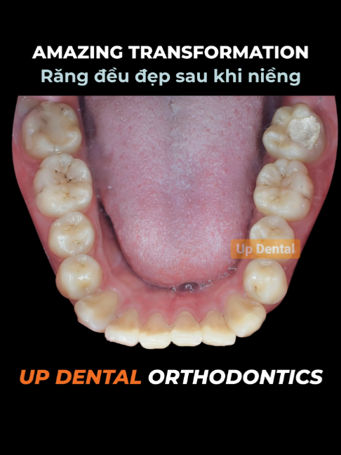 @Nha khoa niềng răng Up Dental