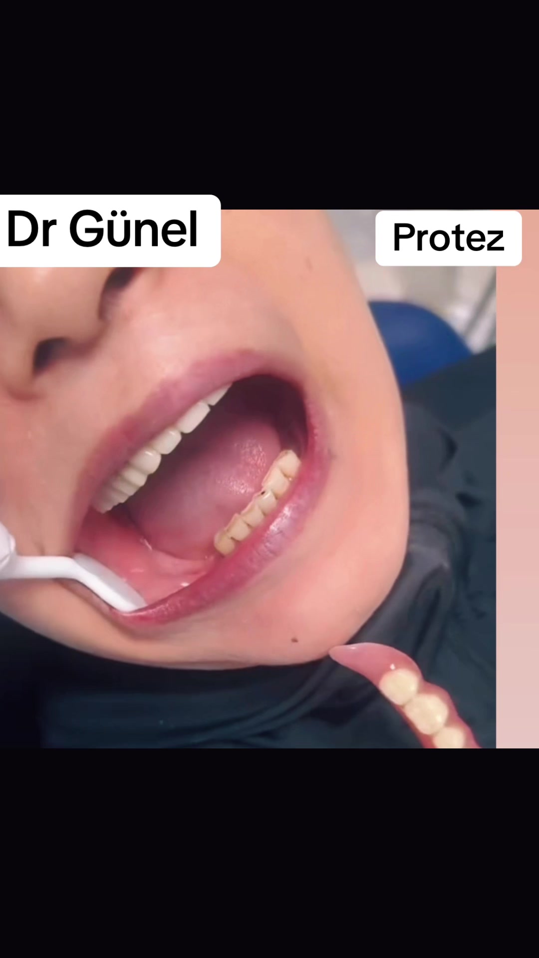 @Dentist_G&uuml;nel