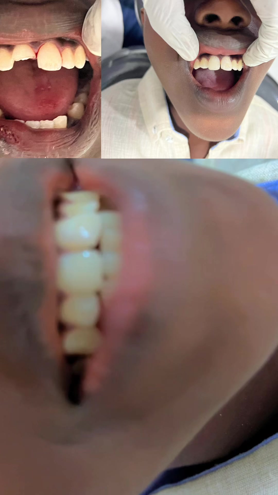 @Dr Abdirahman hassan laari