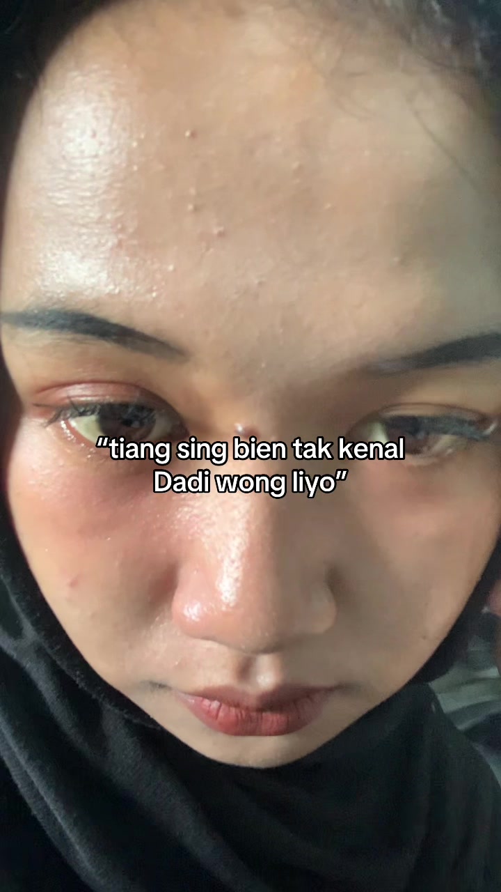 @Nitaa