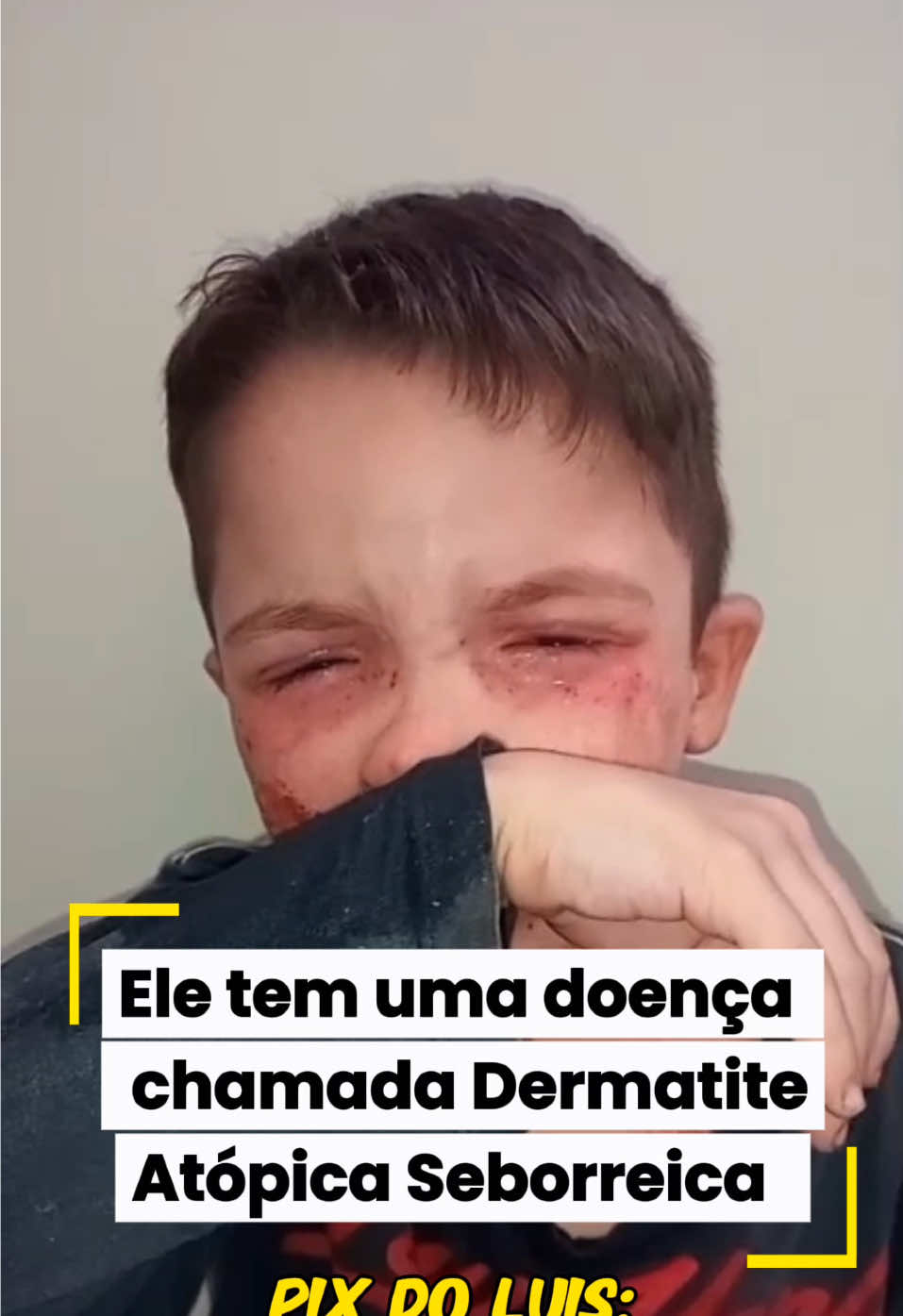 @DinoSonso