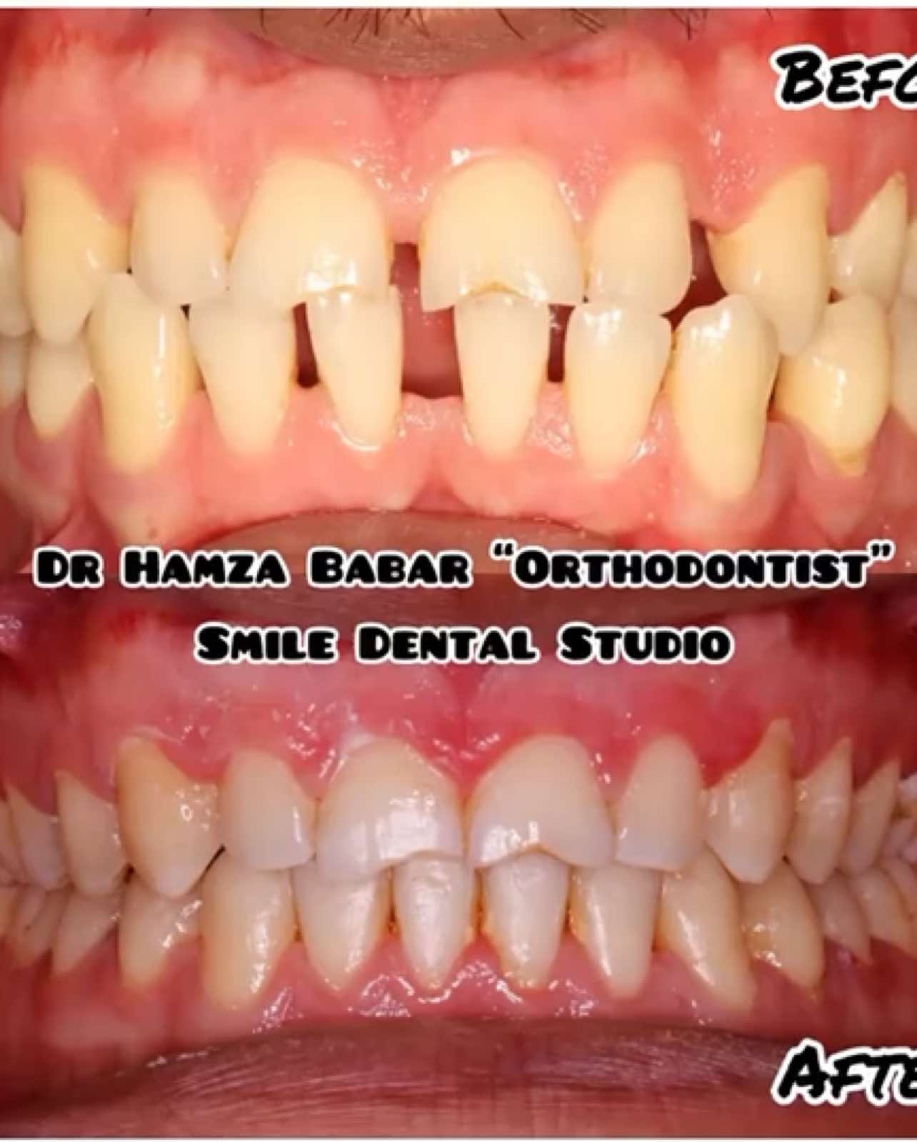 @Smile Dental Studio