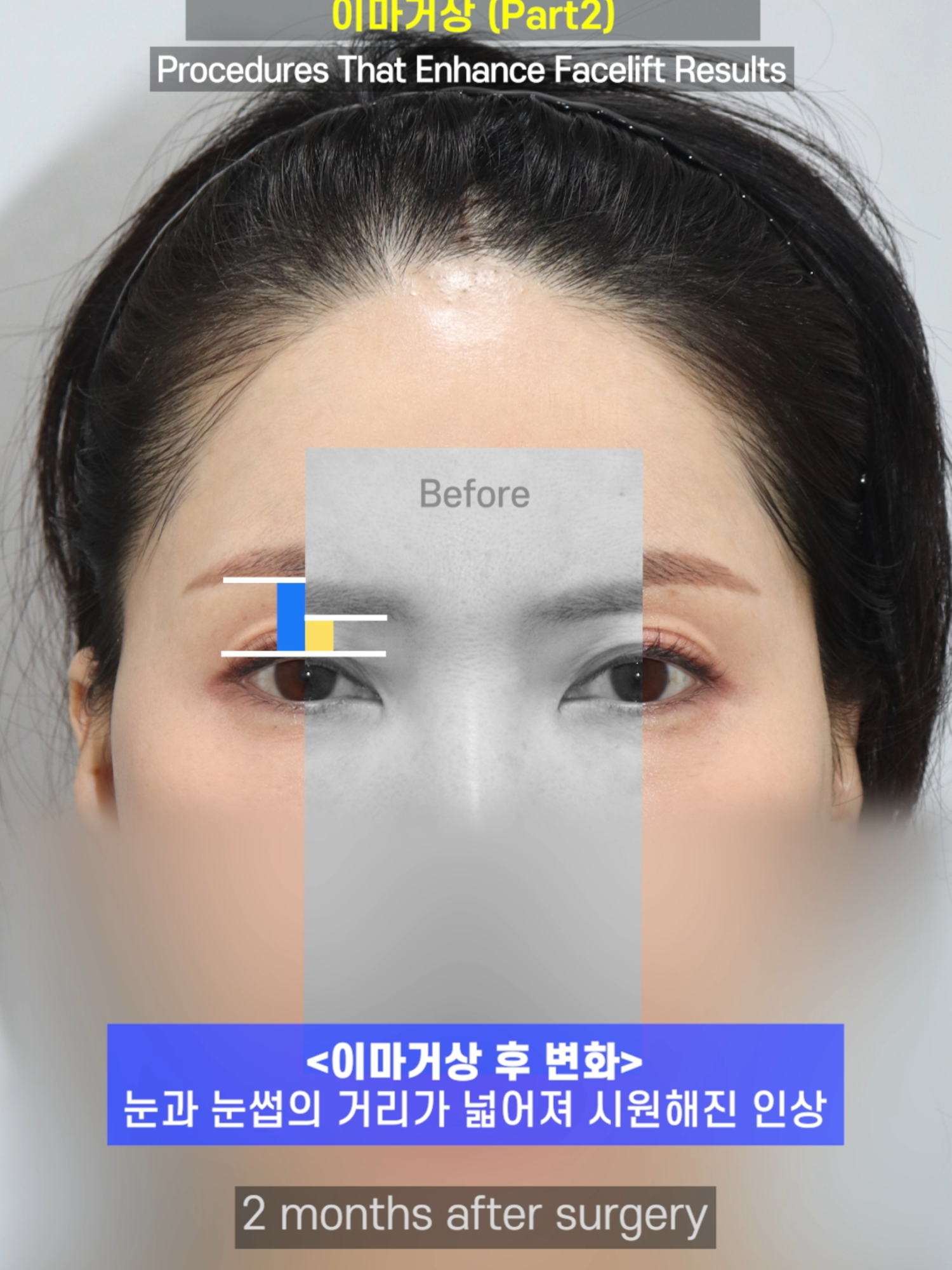 @다시피움성형외과 DASIPIUM タシピウム
