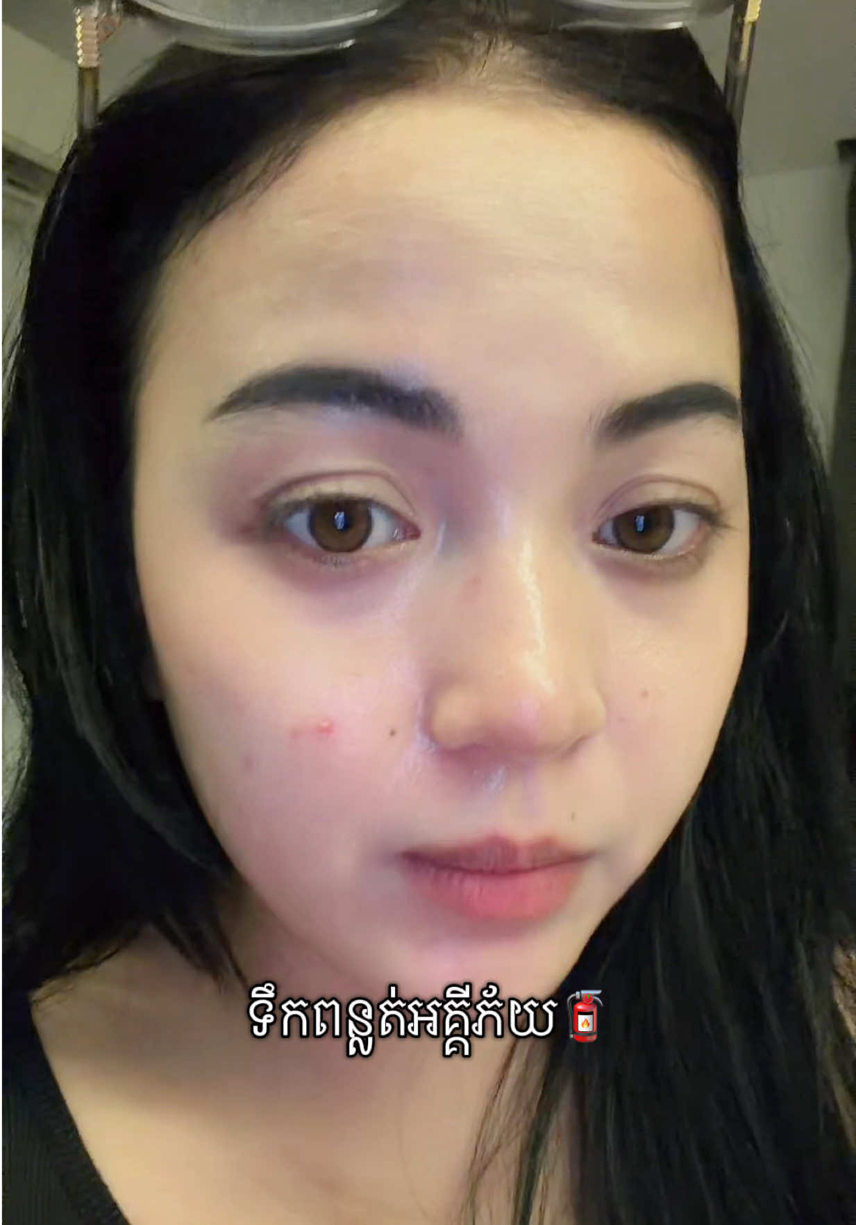 @BetterSkin