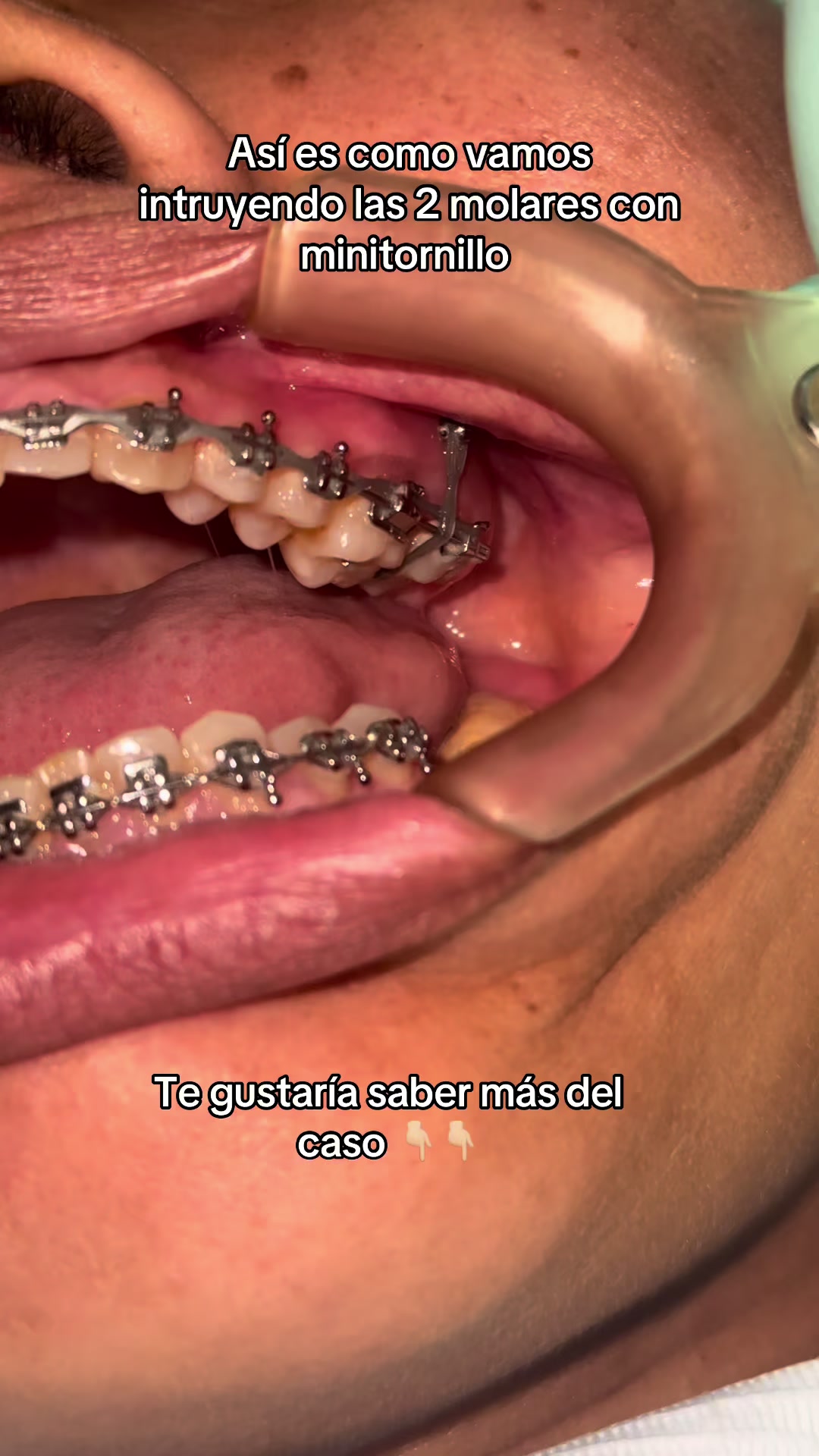 @Dr. Juan Perez | Ortodoncista