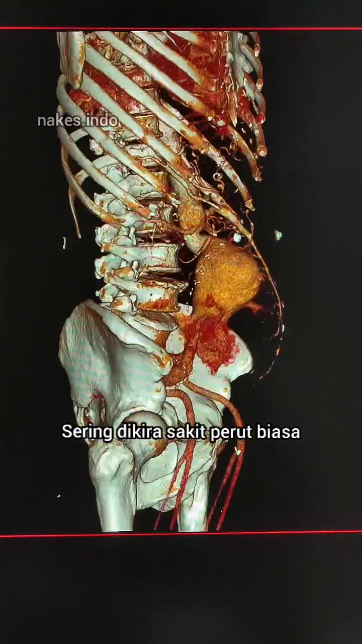 @Sobat Radiology