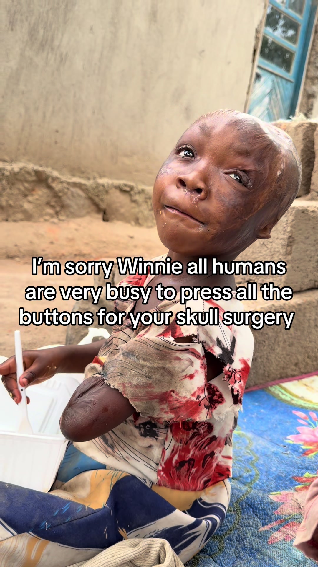 @Matayo Ssentongo