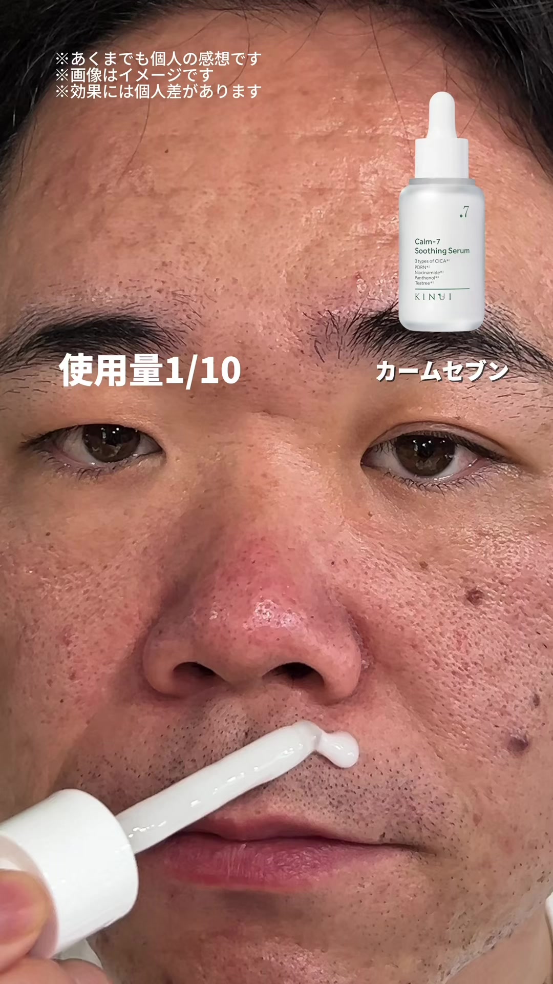 @キルア