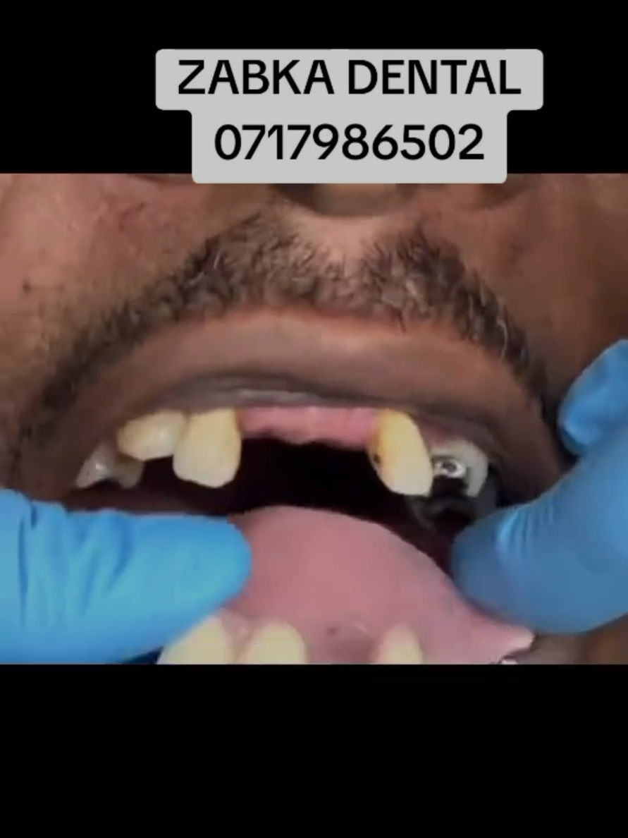 @Zabka Dental