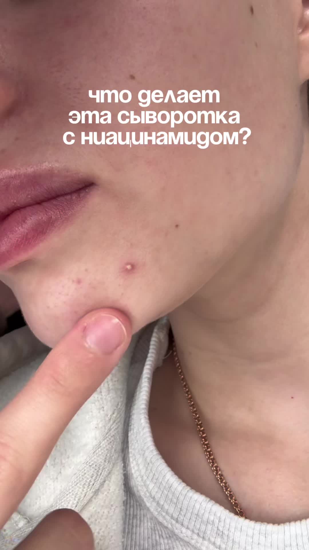 @💗