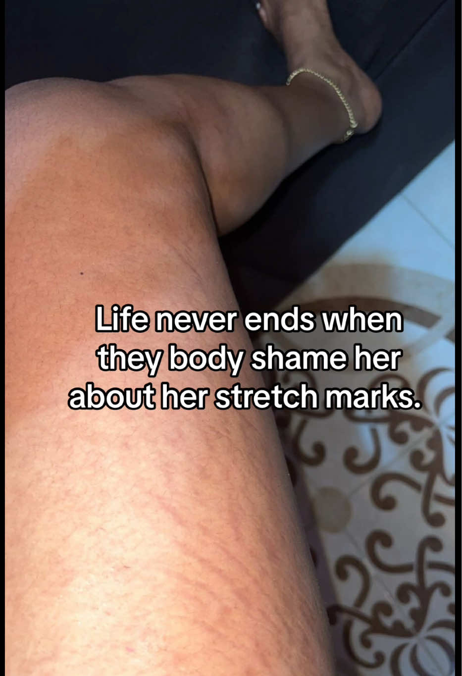 @Stretch_markeraser