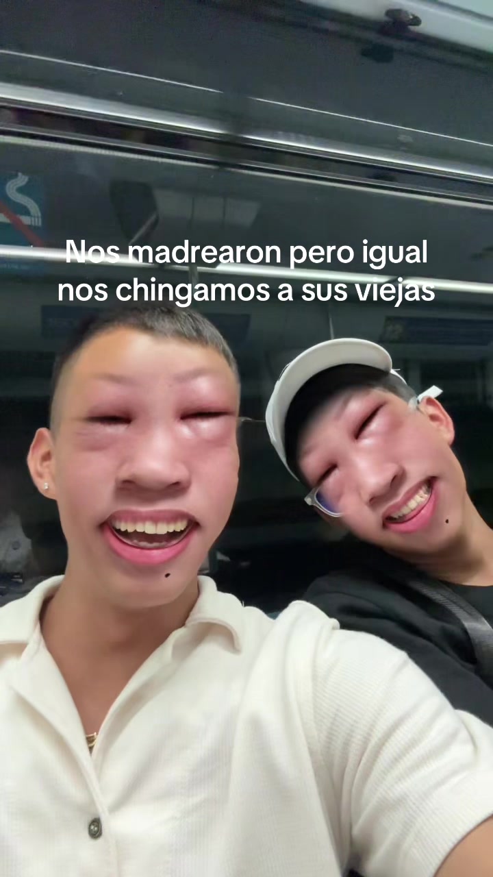 @BANDILO