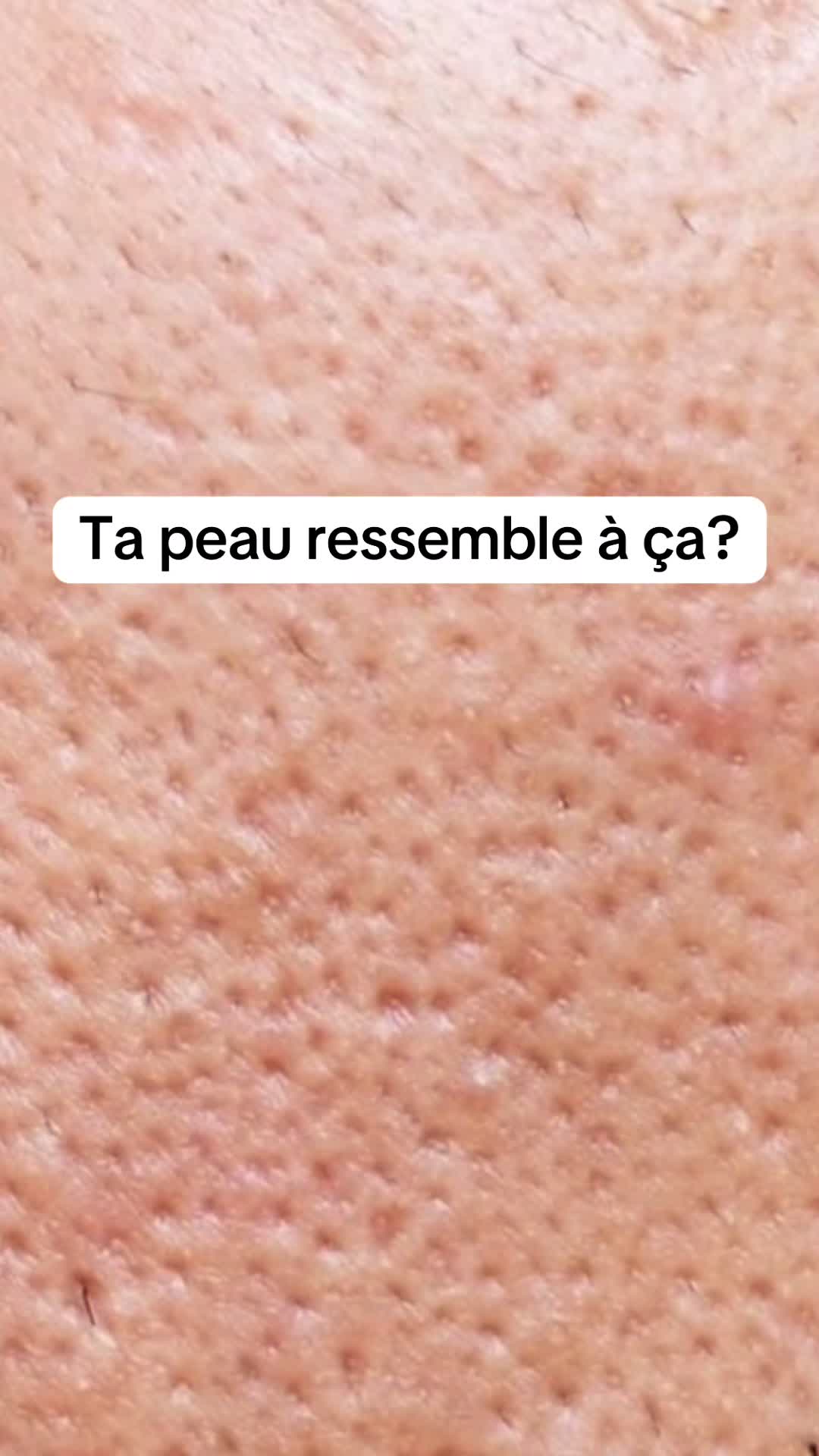 @Bôté Esthétique