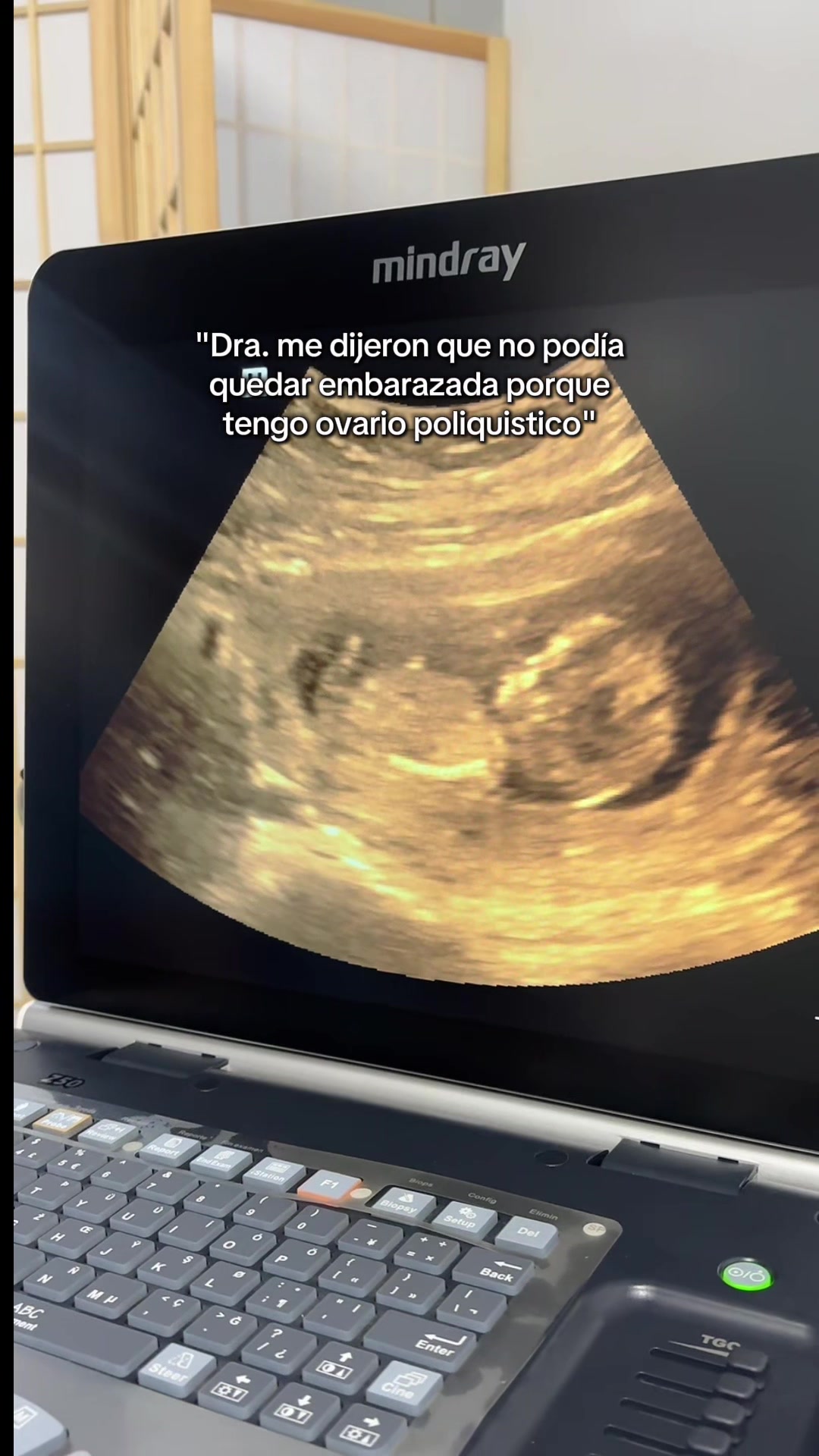 @Obstetric. Shaddai