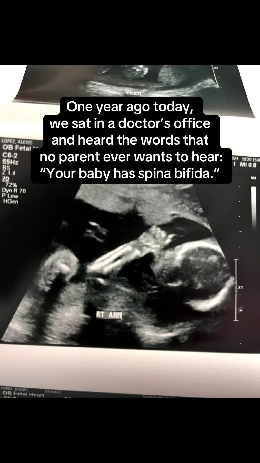 @Lexy | SB Momma🎗️