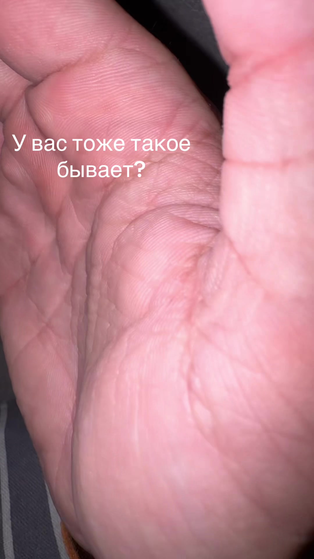 @Limbo