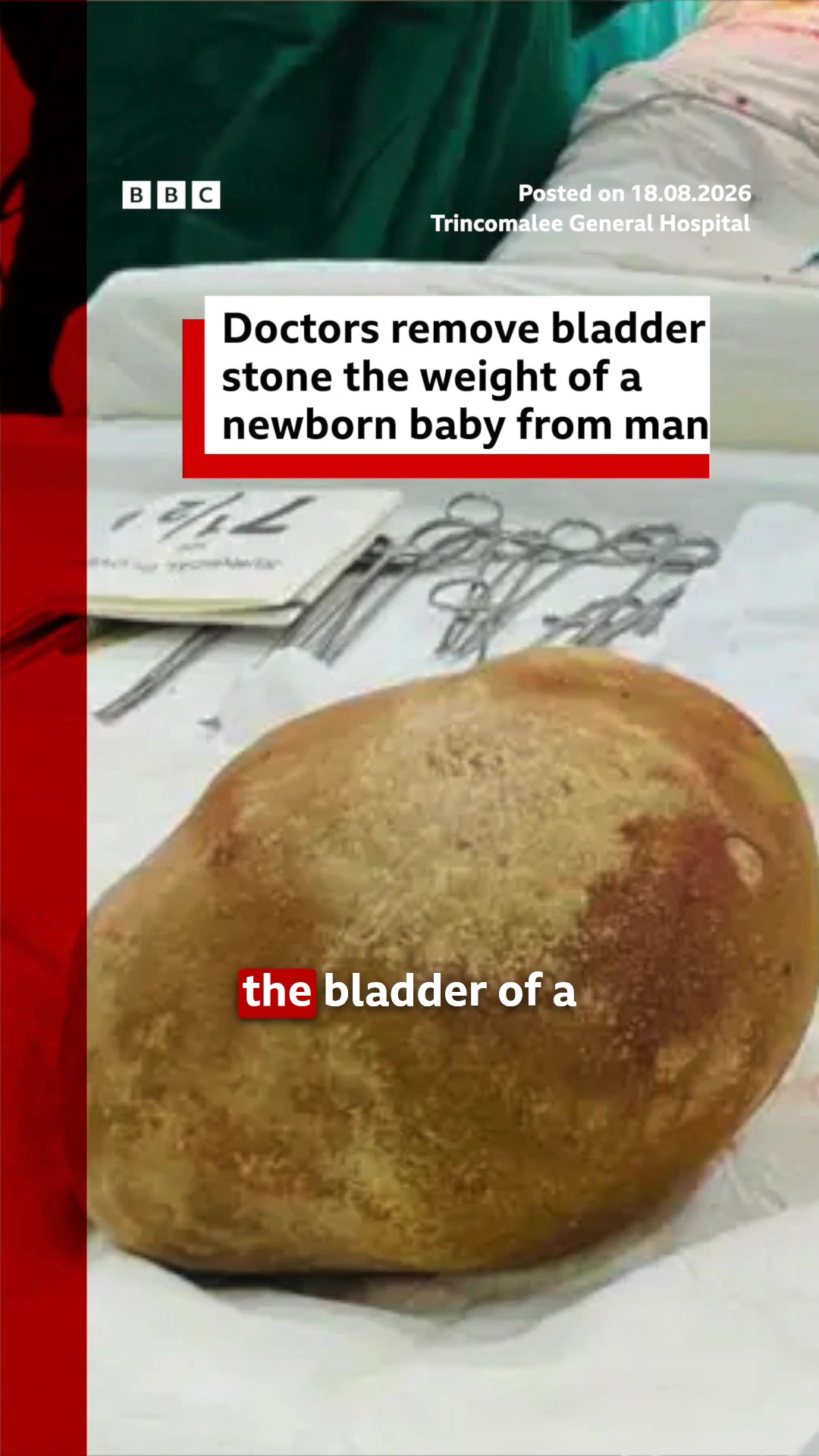 @BBC News