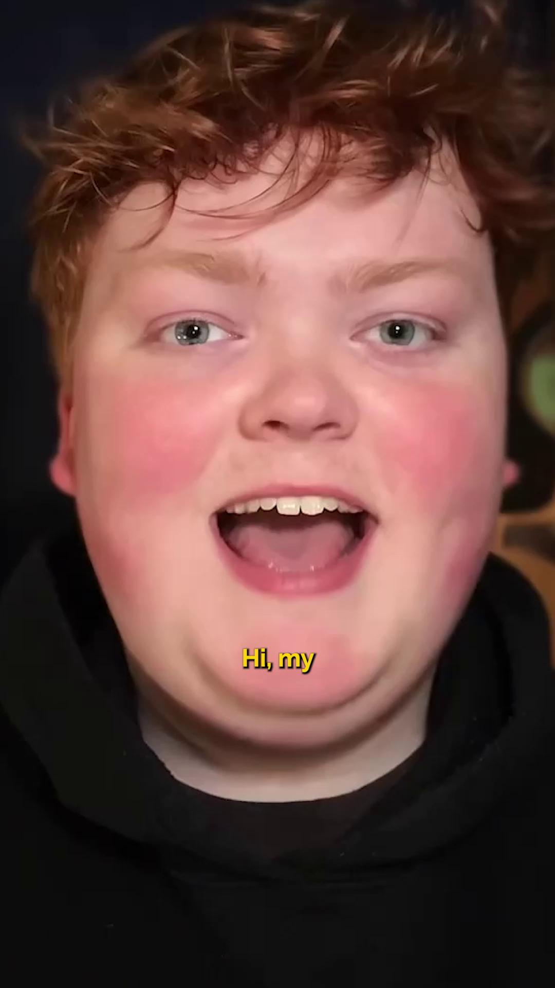 @ARU