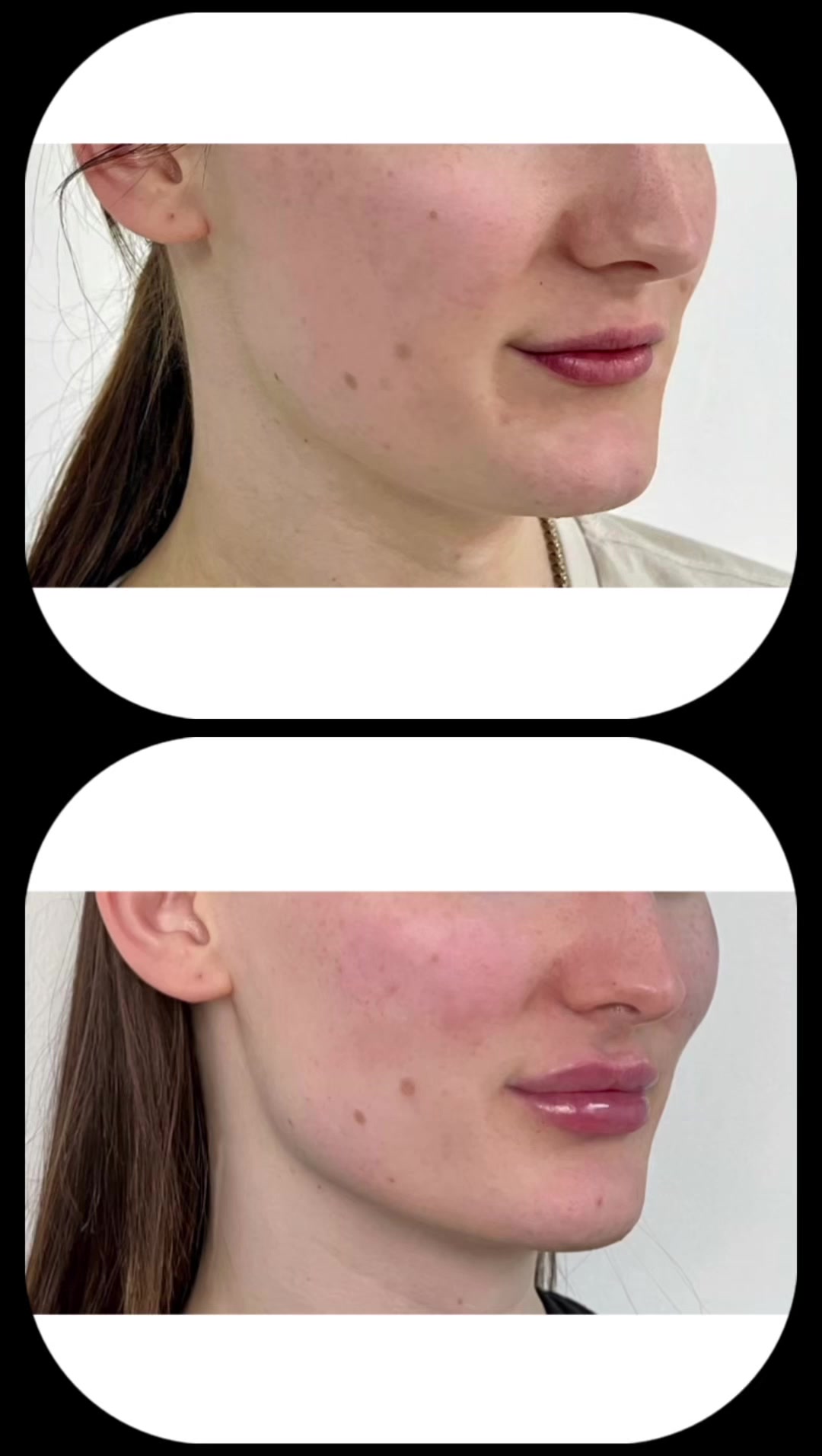 @facesbyroberto