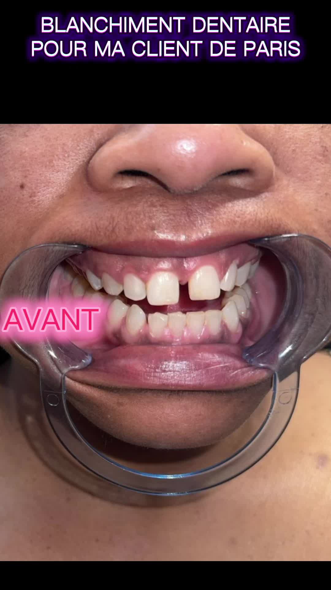 @royalebeauteparis