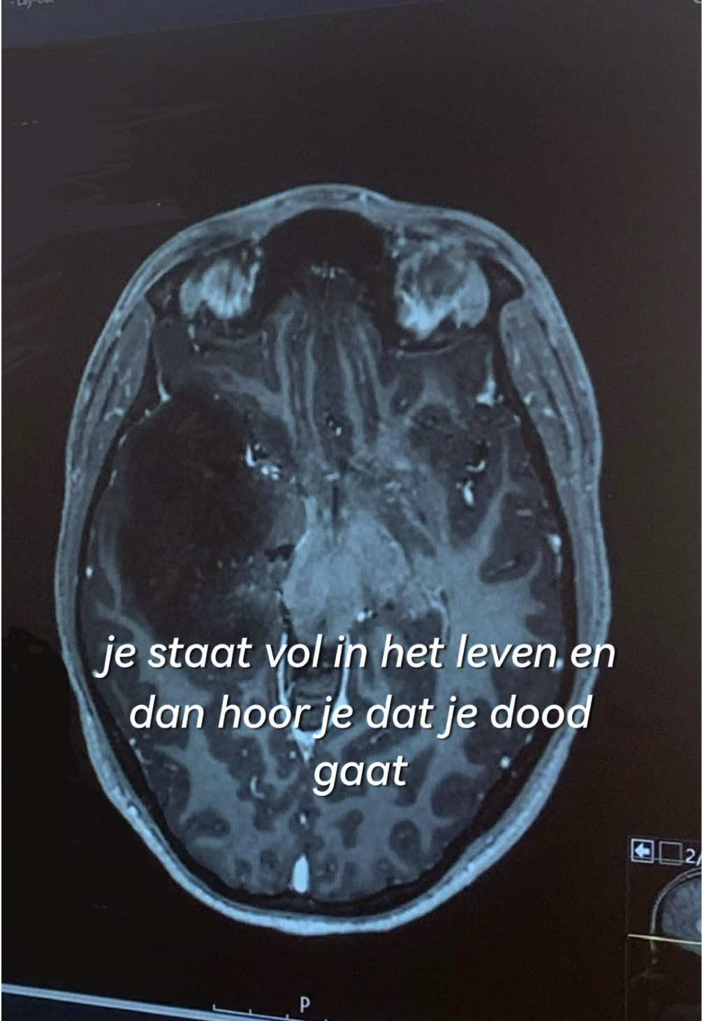 @myrtheraaphorst_