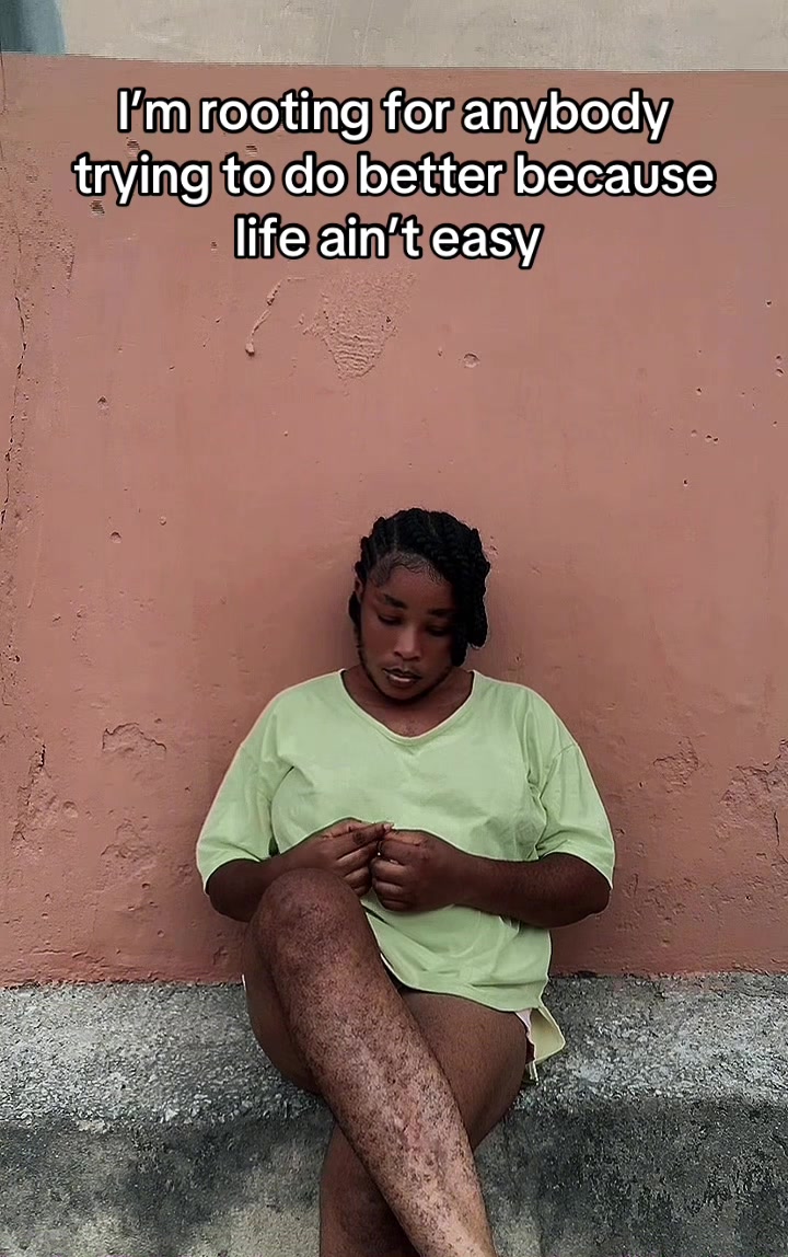 @Dat_hairygirl