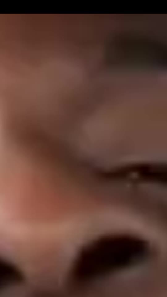 @osasioos.forehead