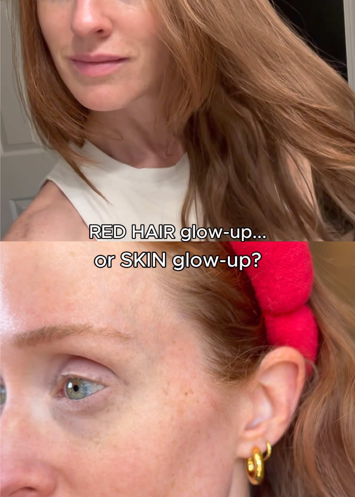 @How to be a Redhead