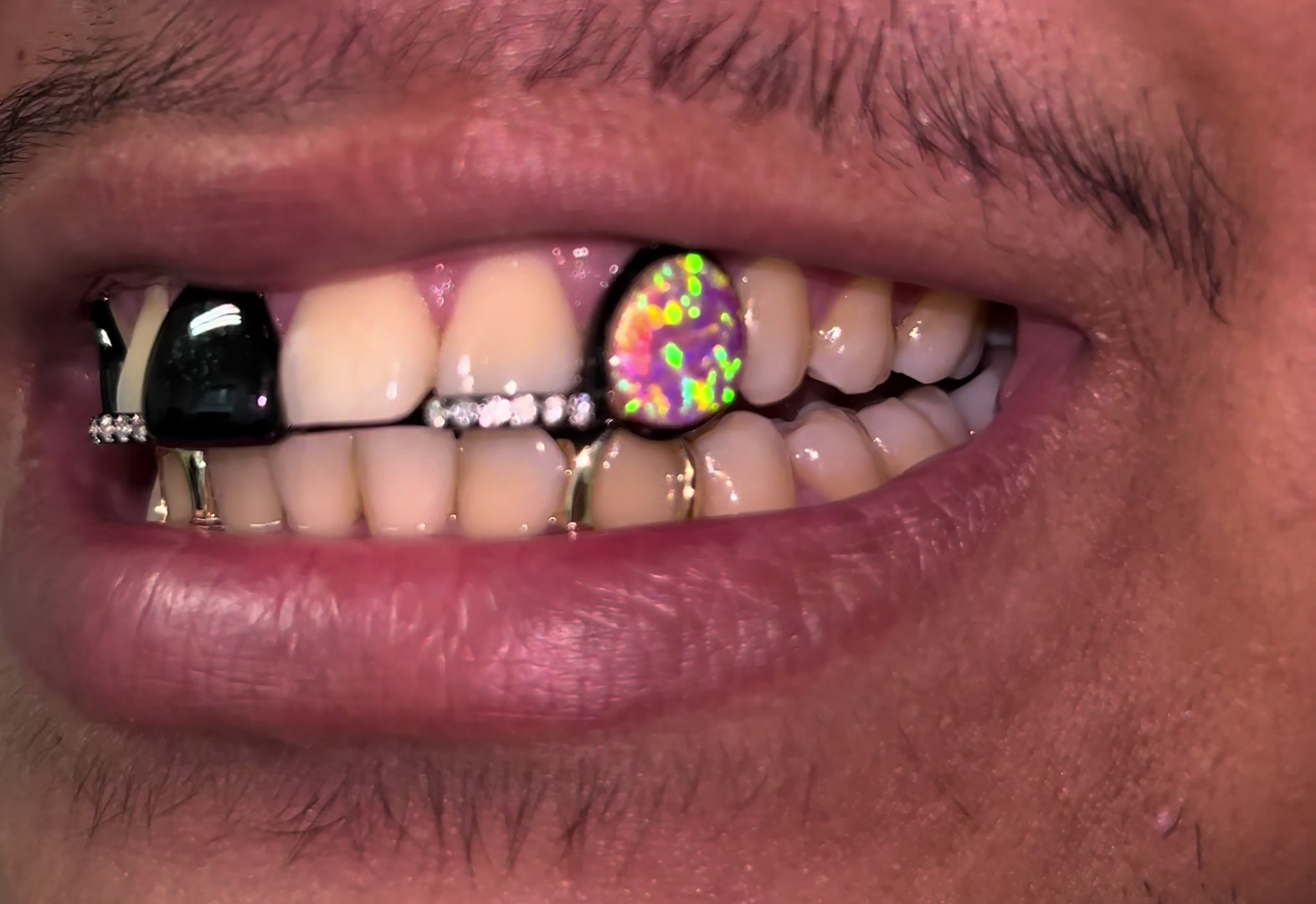 @Grillz & Gold | Bryan