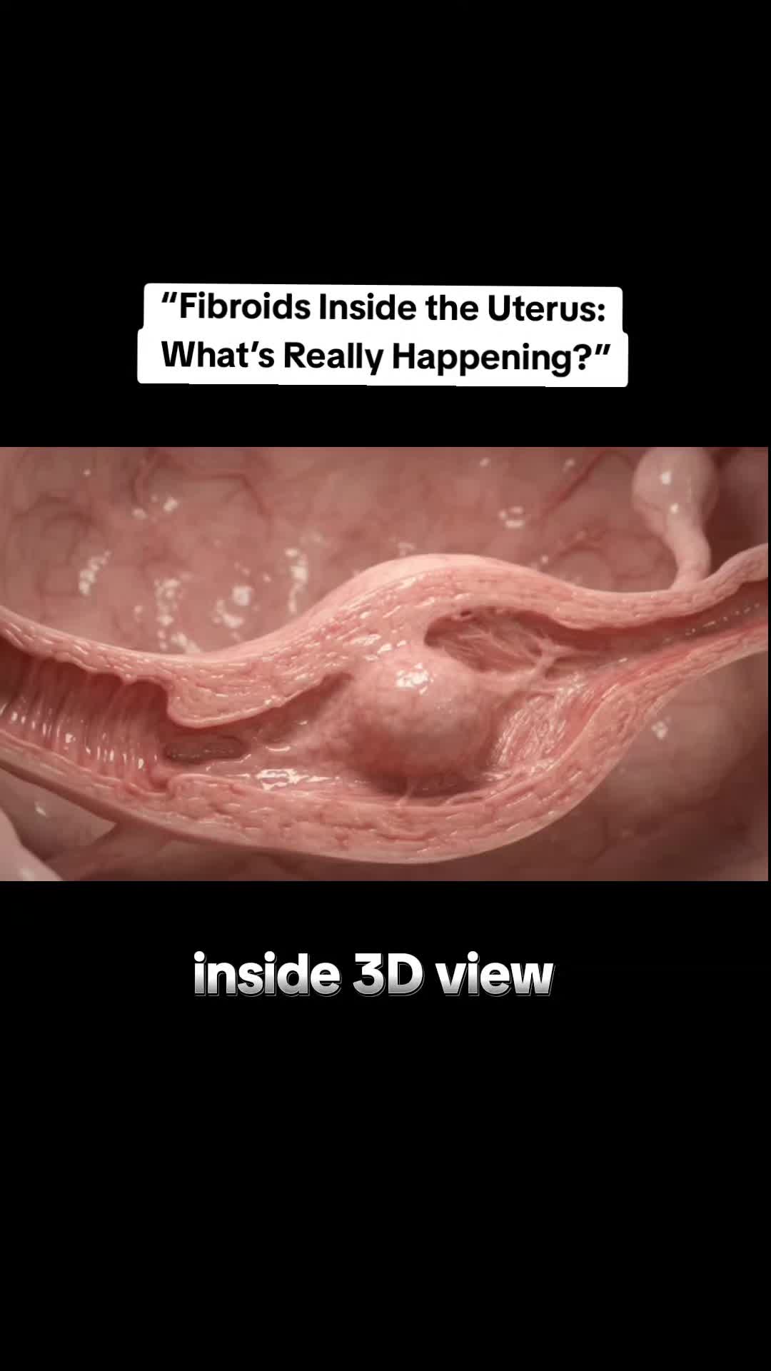 @BABY INSIDE-7