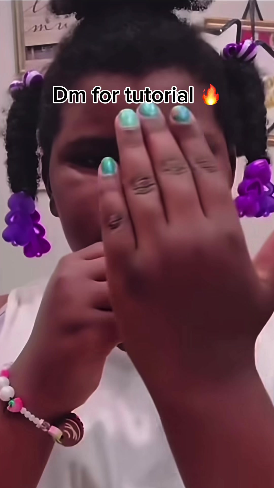@Madara Dusal