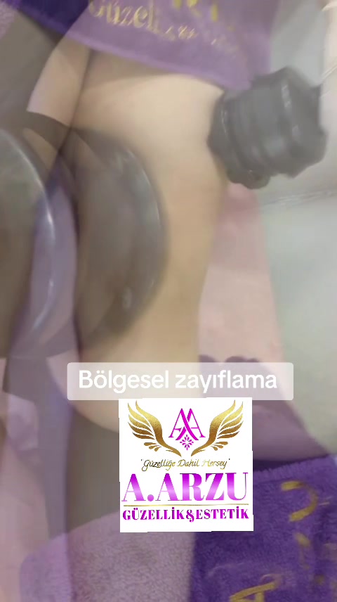 @A.ARZU1990🇦🇿🇹🇷