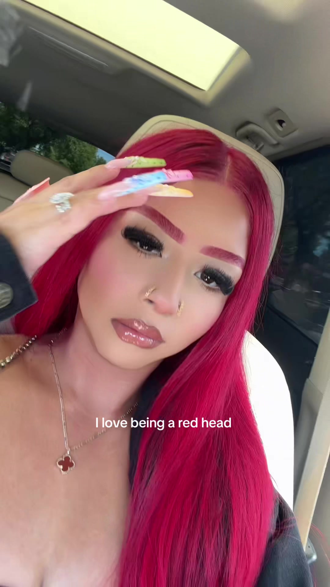 @Michy Orozco