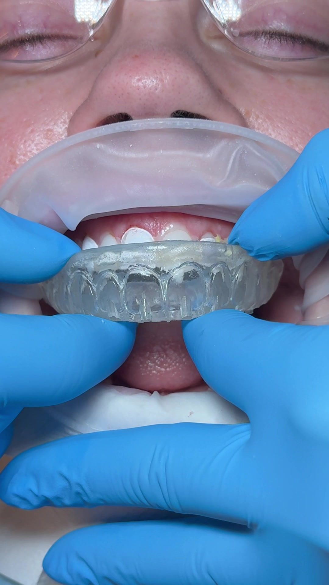 @Dentalexcellenceuk