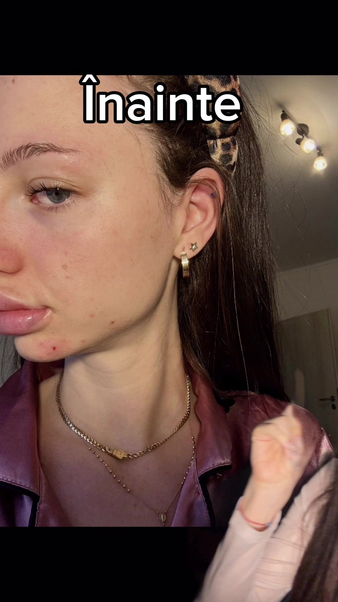 @L9UIZA