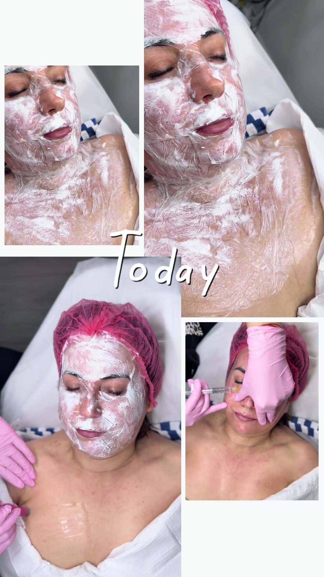 @BeautyBerryClinic_ByJagoda
